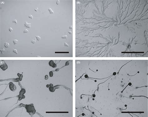  Dictyostelium: Un Caracol de Hongos con Cerebro Colectivo!