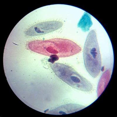  Paramecium: ¿Un pequeño gigante que se mueve como un bailarín microscópico?