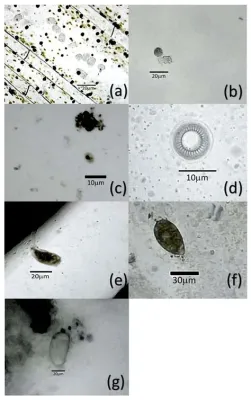  Urosporidium! ¿Un Parásito Invisible que Habita en el Intestino de los Peces?