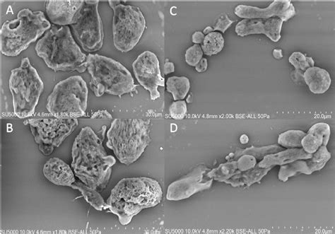  Willaertia magna: Un gigante microscópico que se desliza con gracia! Willaertia magna es un protista unicelular del grupo Amoebozoa conocido por su inusual forma y su movilidad fascinante.