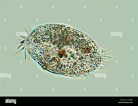   Xiphystera! A Ciliate Master of the Microscopic World